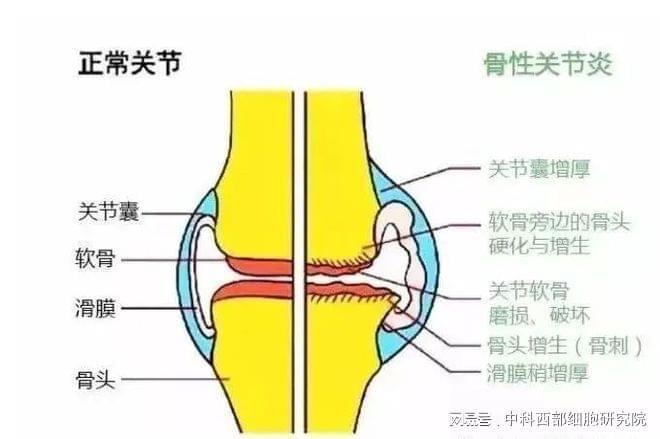 骨质破坏引起的疼痛怎么治疗