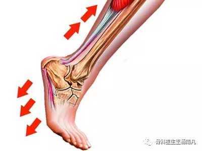 跖筋膜炎怎么治疗