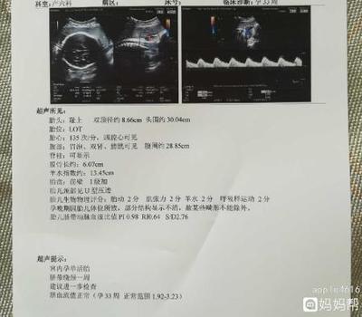 33周宝宝4斤正常吗