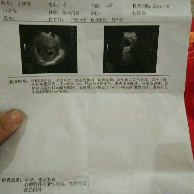怎么看怀孕没