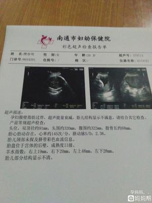 36周宝宝多少斤才正常