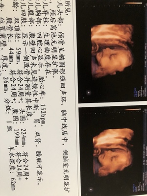 人流一次还能怀孕吗