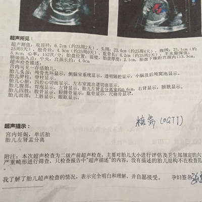 怀孕25周胎儿有多大