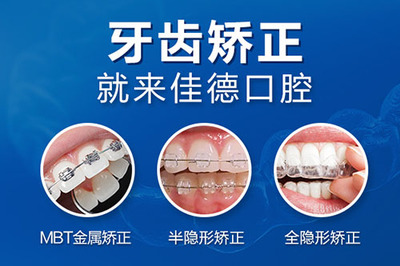 牙齿矫正的费用