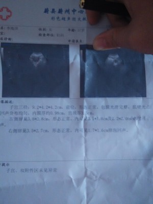 排卵期卵泡多大容易怀孕