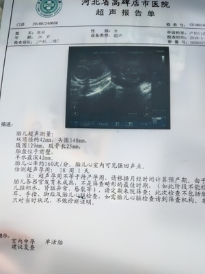 怀孕18周胎儿稳定了吗