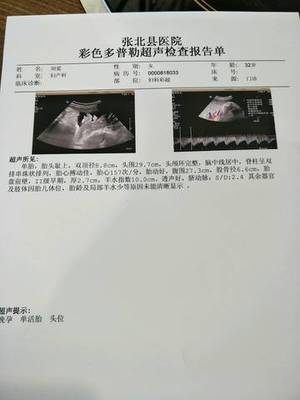 37周宝宝发育标准