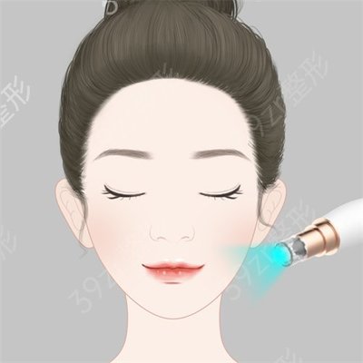 根除痘痘 痘印