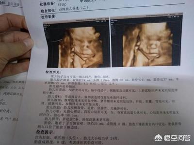 胎儿偏小吃什么长胎