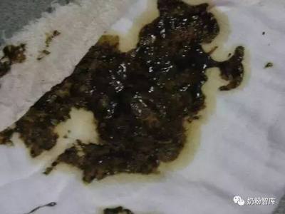 宝宝血便图片