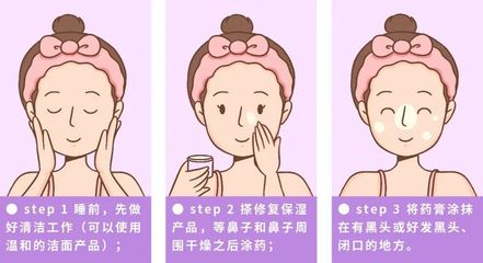 鼻子上痘痘用什么药膏