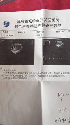 怎么测试男女宝宝最准