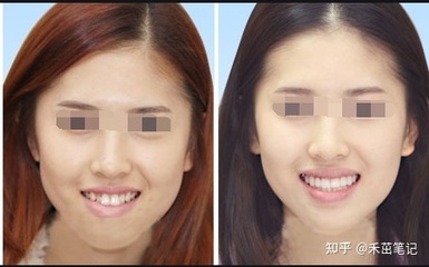 牙齿紧绷是怎么回事