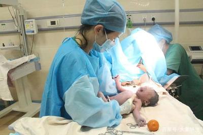 孕妇可以要求剖腹产吗
