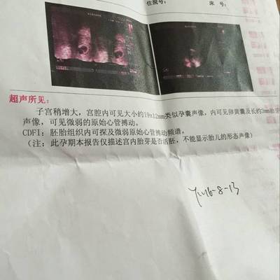 胎儿发育小