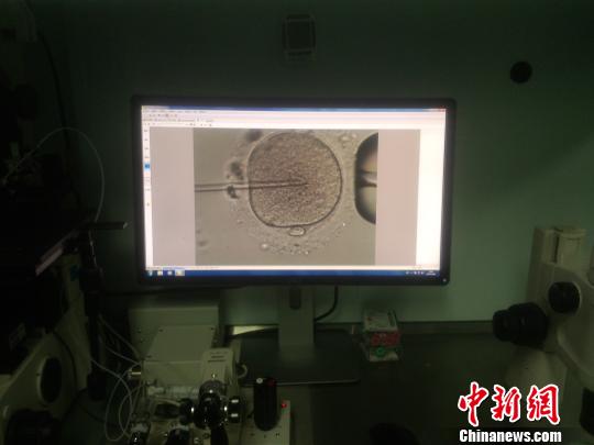 精子多久能到达子宫与卵子结合