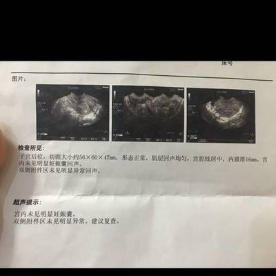 怀孕4周会恶心吗