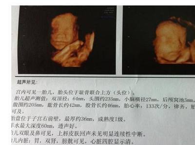 怀孕5个月胎儿一天动多少次正常