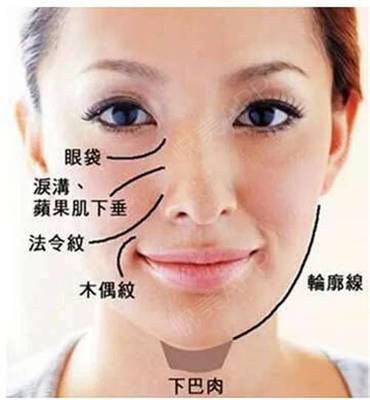 鼻唇沟法令纹