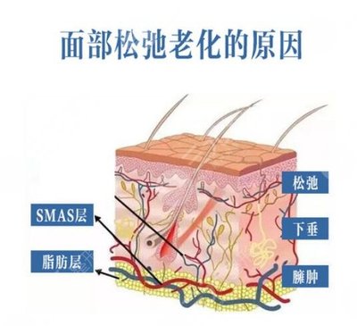 悬吊除皱v美减龄实力