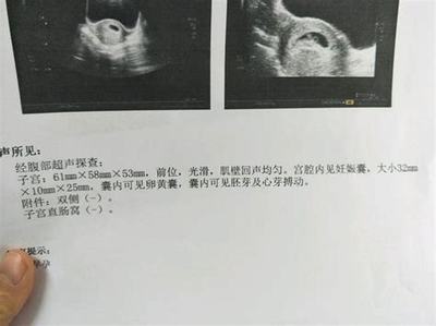 四个月胎动