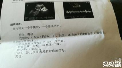 孕19周胎儿双顶径标准