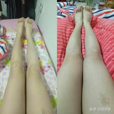 怎么快速瘦肌肉腿