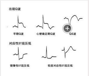 宿舍走道吊顶标高是多少