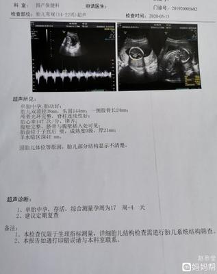 胎儿心跳是什么声音