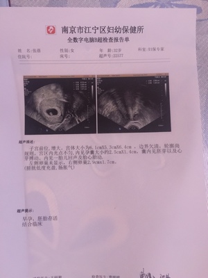 怀孕几个月检查