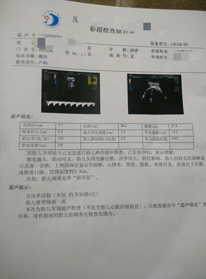 腔内彩超检查多少钱