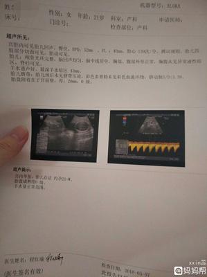 怀孕吃辣的是女儿吗