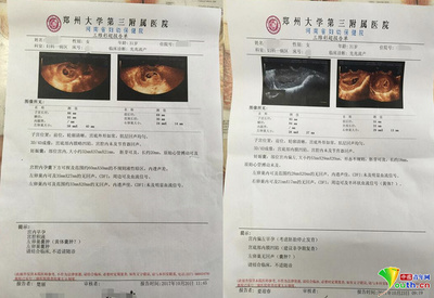 孕妇需要做心脏彩超吗