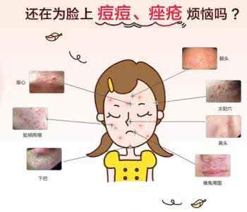 上海专业治疗痘痘痤疮