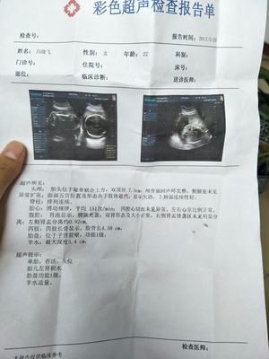 胎儿22周图片