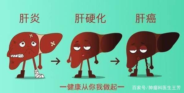 丙型肝炎是怎么回事