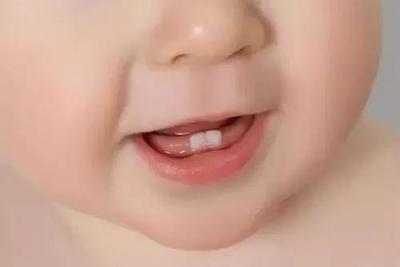 宝宝出牙早命不好吗