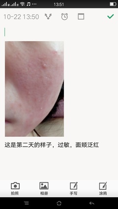 脸上痘痘留下的斑怎么办