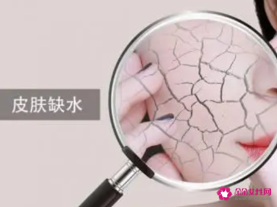 皮肤太干长痘痘