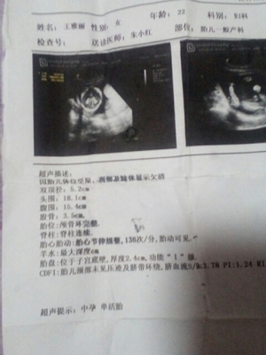 怀孕6个多月胎动少正常吗