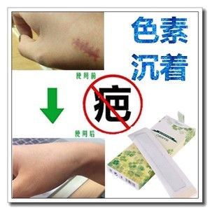 怎样去除痘痘黑印最快