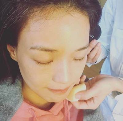 双下巴长痘痘什么原因