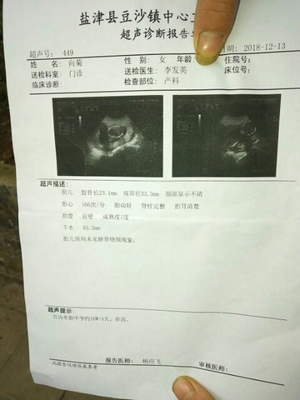怀孕19周胎动频繁正常吗