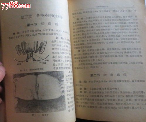 痔漏是怎么回事