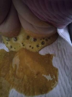 宝宝一天拉三次大便有点稀薄
