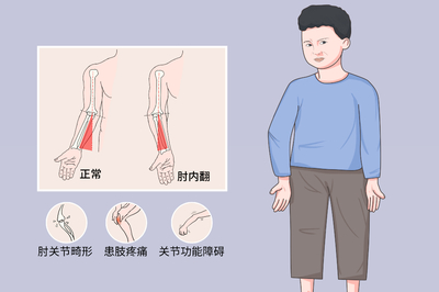 劳累胳膊肘关节疼痛怎么治疗