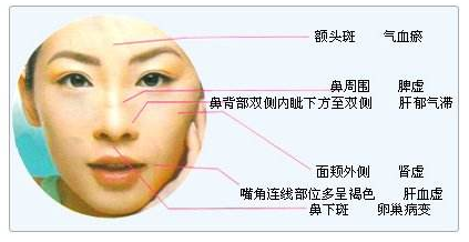 眼部黄褐斑