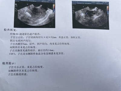 全麻之后多久可以怀孕