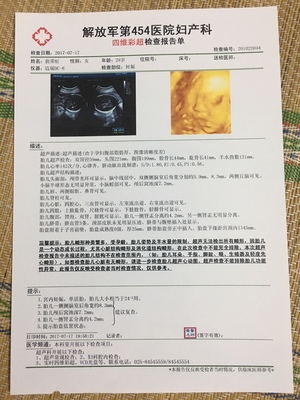 孕妇肾盂分离是什么意思