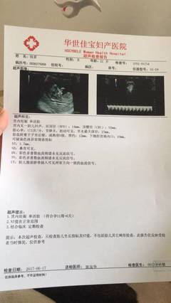 胎儿什么时候长脐带